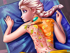 Ice Queen Back Treatment