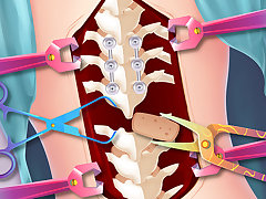 Anna Scoliosis Surgery